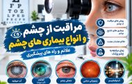 انواع بیماری های چشم