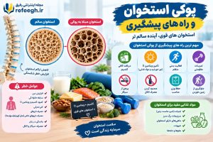 پوکی استخوان و راه های پیشگیری